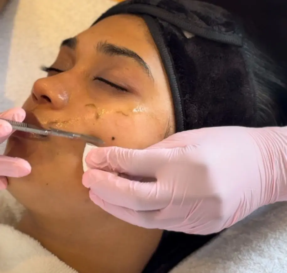 Dermaplane Facial