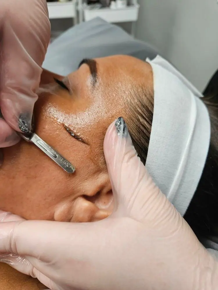 Before Skin Rejuvenation